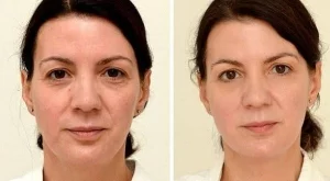 Какво се случва, когато пиете по 3 л вода на ден
